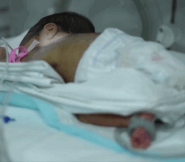 Türkiye’de 100 bebekten 13’ü prematüre dünyaya geliyor!